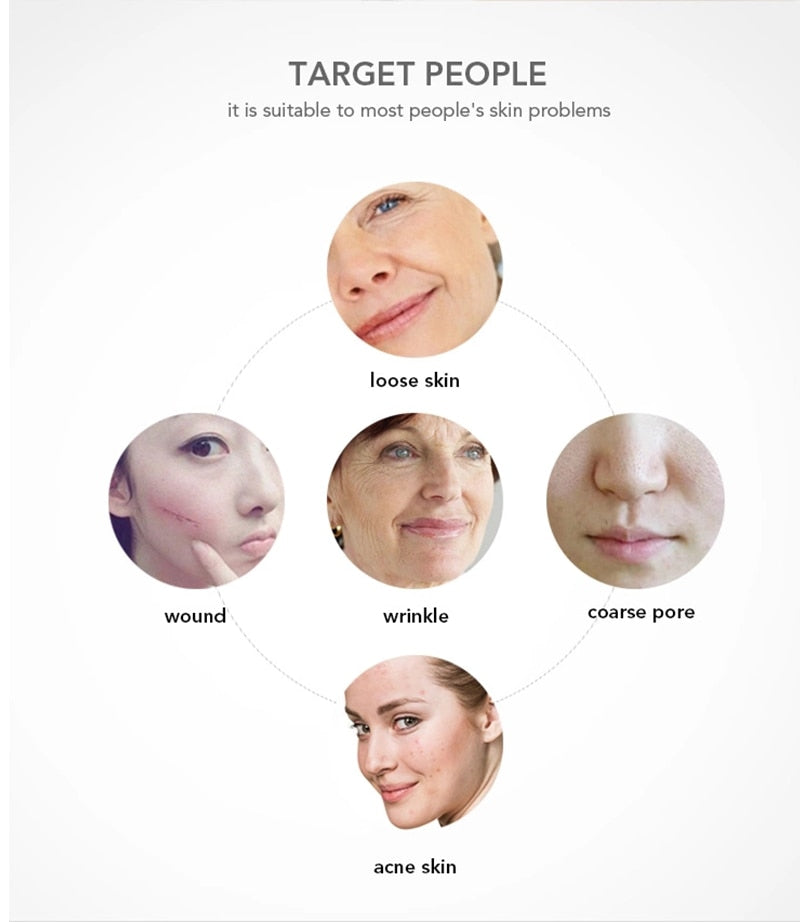 High Frequency Facial Machine Electrotherapy Pro Skin Treatment Wand Glass FUSION (Neon + Argon Wands)