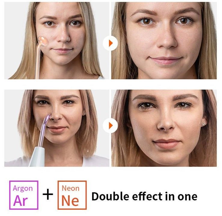 High Frequency Facial Machine Electrotherapy Pro Skin Treatment Wand Glass FUSION (Neon + Argon Wands)